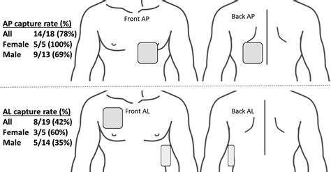 anteroposterior